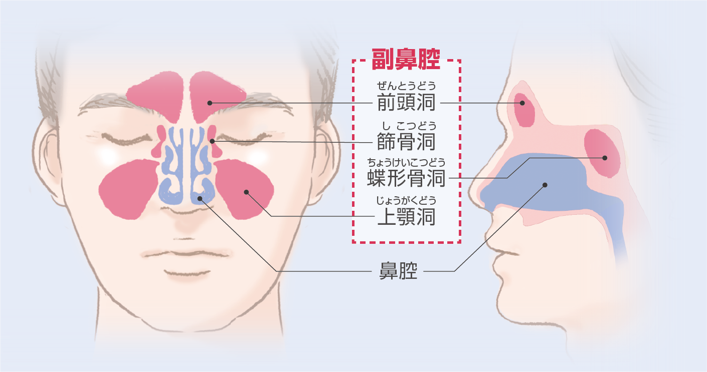 副鼻腔炎の図