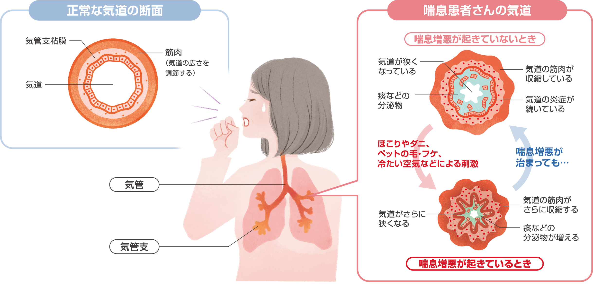 喘息の図